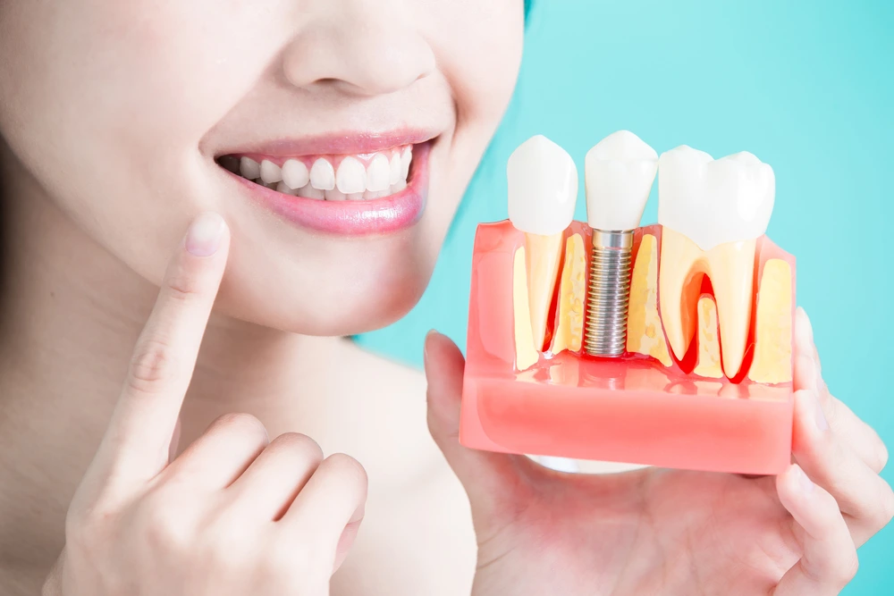 Dental Implants In Ravet, Punawale, Wakad, Hinjewadi, Marunji